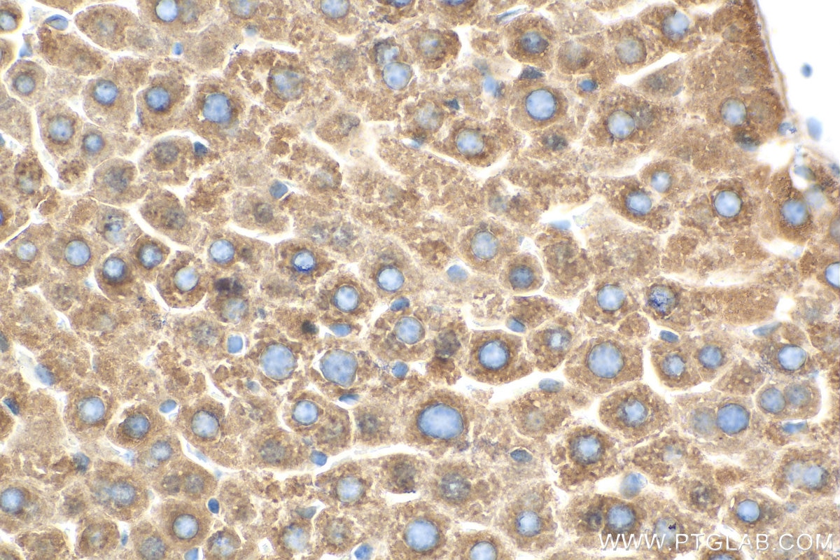 Immunohistochemistry (IHC) staining of mouse liver tissue using FADS2 Monoclonal antibody (68026-1-Ig)