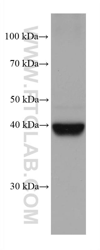 Western Blot (WB) analysis of LNCaP cells using FADS2 Monoclonal antibody (68026-1-Ig)