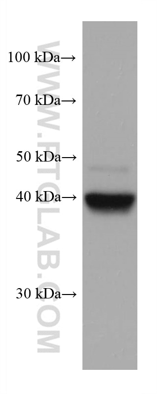 Western Blot (WB) analysis of Jurkat cells using FADS2 Monoclonal antibody (68026-1-Ig)