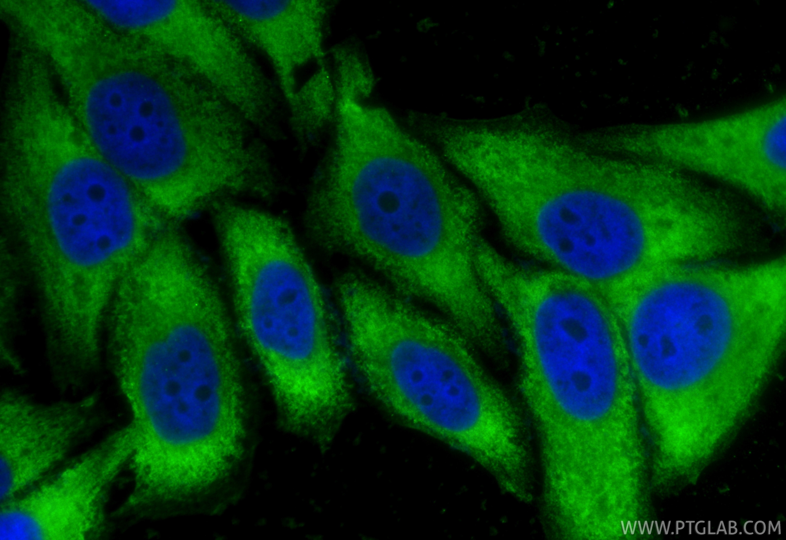 Immunofluorescent analysis of (-20°C Ethanol) fixed HepG2 cells using CoraLite® Plus 488 FADS2 antibody (CL488-84527-5, Clone: 241863G3 ) at dilution of 1:200. Immunofluorescence (IF) / fluorescent staining of HepG2 cells using CoraLite® Plus 488-conjugated FADS2 Recombinant mo (CL488-84527-5)