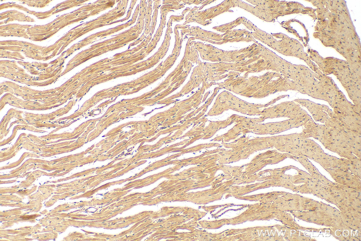 Immunohistochemistry (IHC) staining of mouse heart tissue using FADS2 Polyclonal antibody (28034-1-AP)