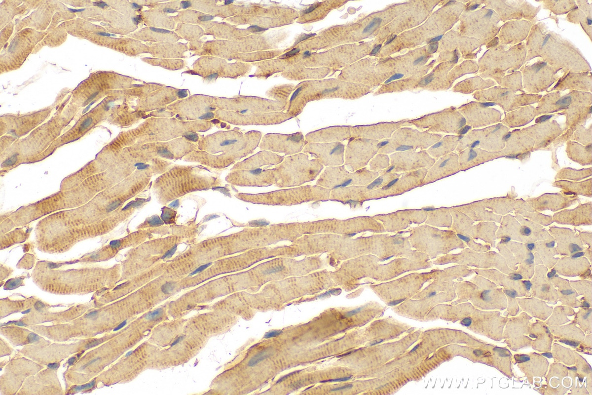 Immunohistochemistry (IHC) staining of mouse heart tissue using FADS2 Polyclonal antibody (28034-1-AP)