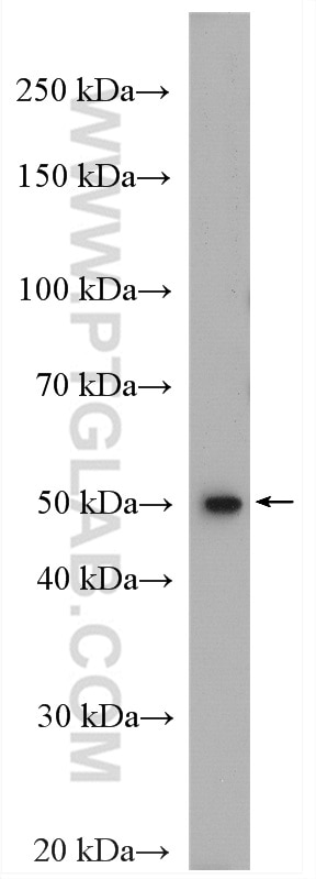 Western Blot (WB) analysis of mouse liver tissue using FADS2 Polyclonal antibody (28034-1-AP)