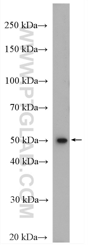 WB analysis of mouse liver using 28034-1-AP