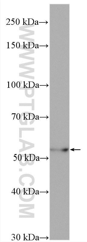 Western Blot (WB) analysis of rat liver tissue using FADS2 Polyclonal antibody (28034-1-AP)
