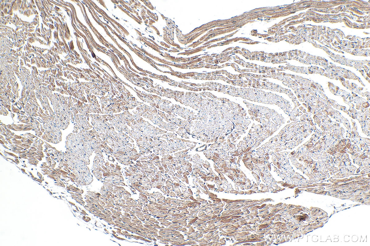Immunohistochemistry (IHC) staining of mouse heart tissue using FADS2 Recombinant monoclonal antibody (84527-4-RR)