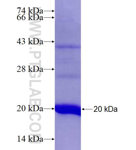 FADS2-Specific fusion protein Ag27715 SDS-PAGE