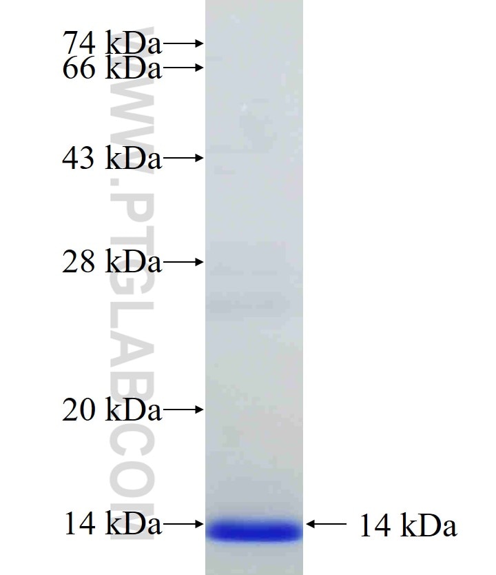 FADS2-Specific fusion protein Ag33119 SDS-PAGE FADS2-Specific fusion protein Ag33119 SDS-PAGE