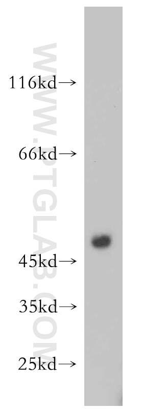 Western Blot (WB) analysis of mouse kidney tissue using FADS3 Polyclonal antibody (15205-1-AP)