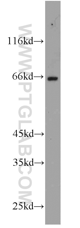 Western Blot (WB) analysis of HeLa cells using FAF1 Polyclonal antibody (10271-1-AP)