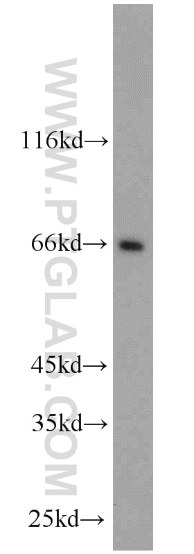 Western Blot (WB) analysis of mouse testis tissue using FAF1 Polyclonal antibody (10271-1-AP)