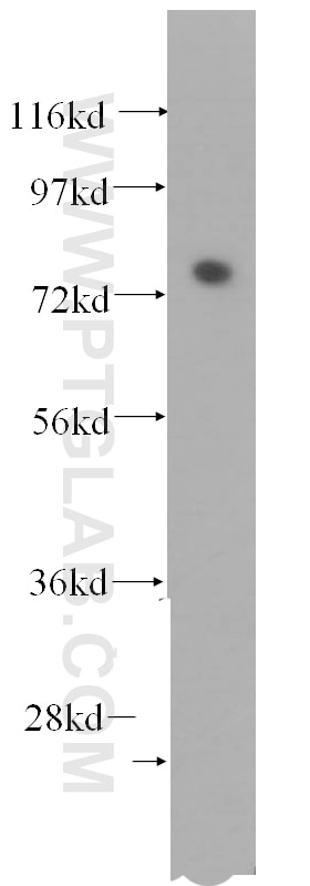 Western Blot (WB) analysis of mouse brain tissue using FAF1 Polyclonal antibody (10271-1-AP)