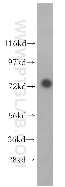 Western Blot (WB) analysis of K-562 cells using FAF1 Polyclonal antibody (10271-1-AP)