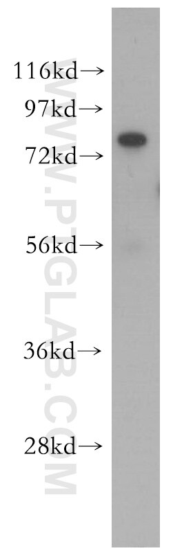 Western Blot (WB) analysis of HEK-293 cells using FAF1 Polyclonal antibody (10271-1-AP)