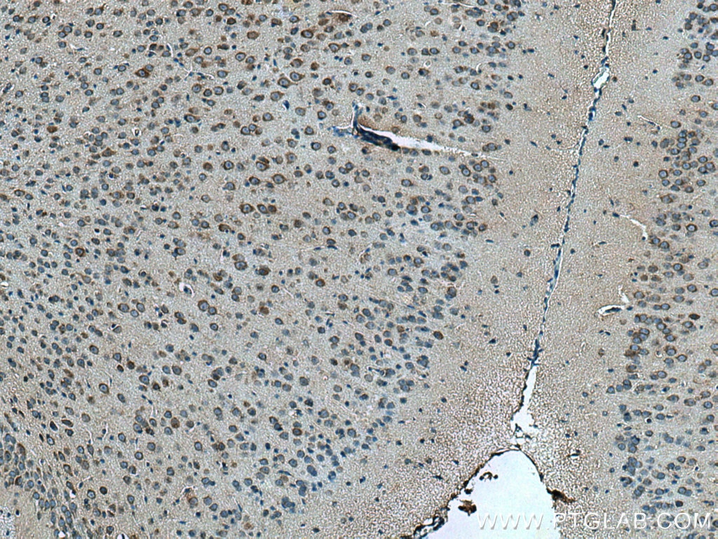 Immunohistochemistry (IHC) staining of mouse brain tissue using FAF2 Polyclonal antibody (16251-1-AP)