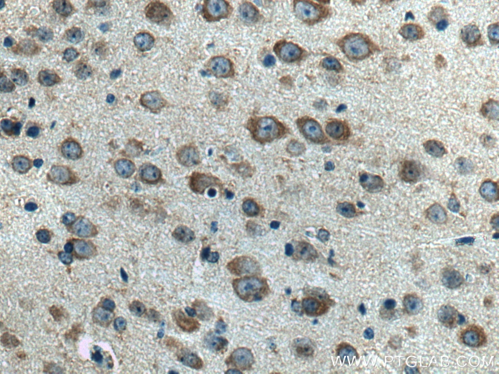 Immunohistochemistry (IHC) staining of mouse brain tissue using FAF2 Polyclonal antibody (16251-1-AP)