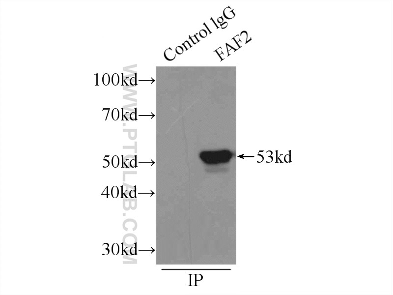 Immunoprecipitation (IP) experiment of mouse brain tissue using FAF2 Polyclonal antibody (16251-1-AP)