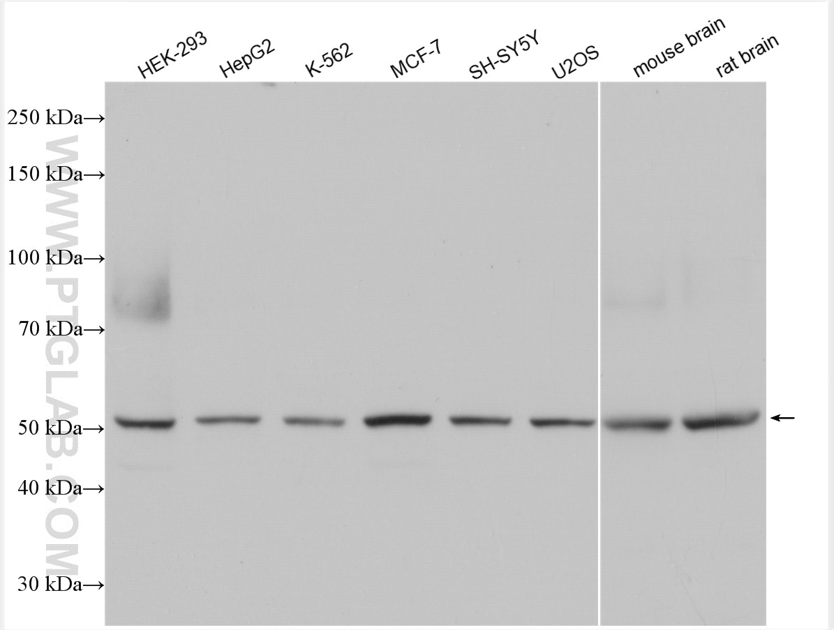 Western Blot (WB) analysis of various lysates using FAF2 Polyclonal antibody (16251-1-AP)