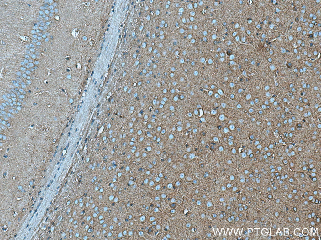 Immunohistochemistry (IHC) staining of mouse brain tissue using FAF2 Monoclonal antibody (66629-1-Ig)