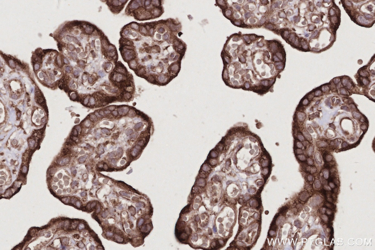 IHC staining of human placenta using 66629-1-Ig Immunohistochemistry (IHC) staining of human placenta tissue using FAF2 Monoclonal antibody (66629-1-Ig)