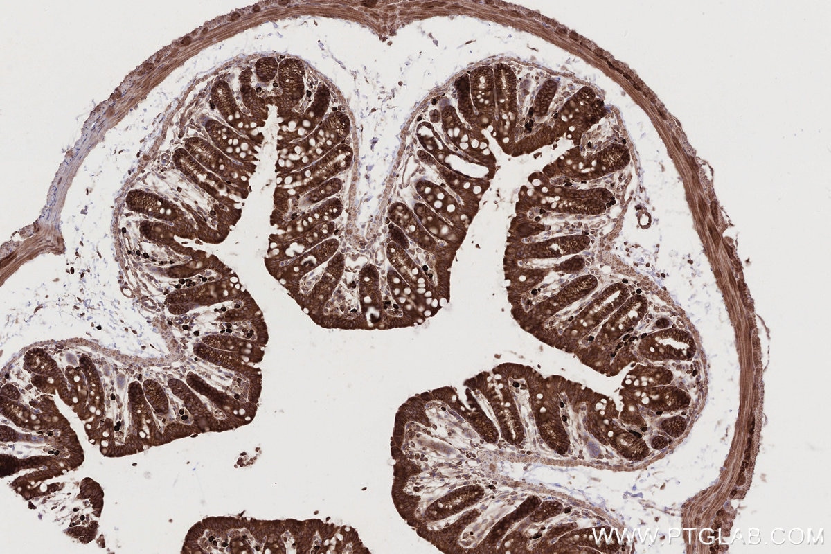IHC staining of mouse colon using 66629-1-Ig Immunohistochemistry (IHC) staining of mouse colon tissue using FAF2 Monoclonal antibody (66629-1-Ig)