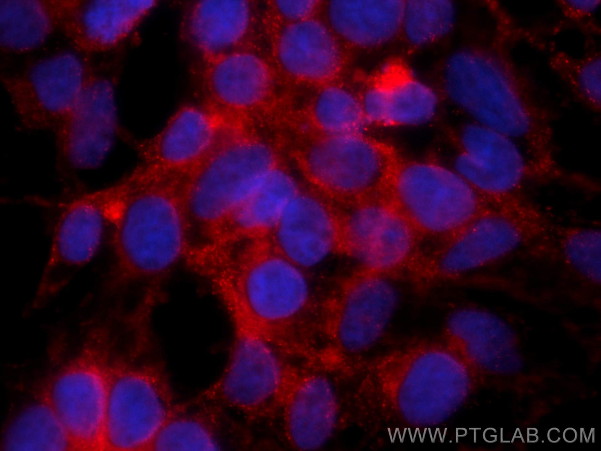 Immunofluorescence (IF) / fluorescent staining of HEK-293 cells using CoraLite®594-conjugated FAF2 Monoclonal antibody (CL594-66629)