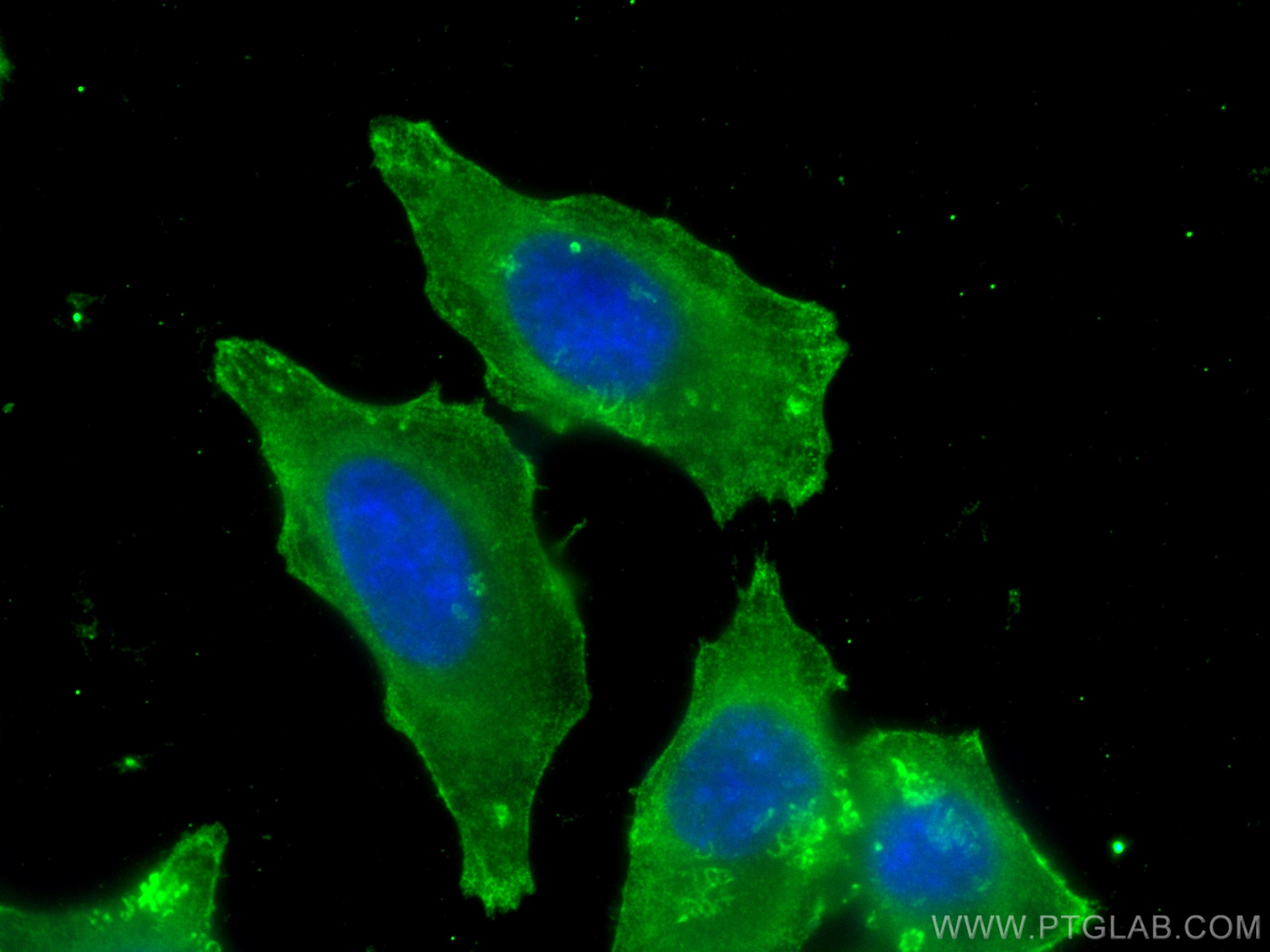 Immunofluorescence (IF) / fluorescent staining of HepG2 cells using FAH Monoclonal antibody (67986-1-Ig)