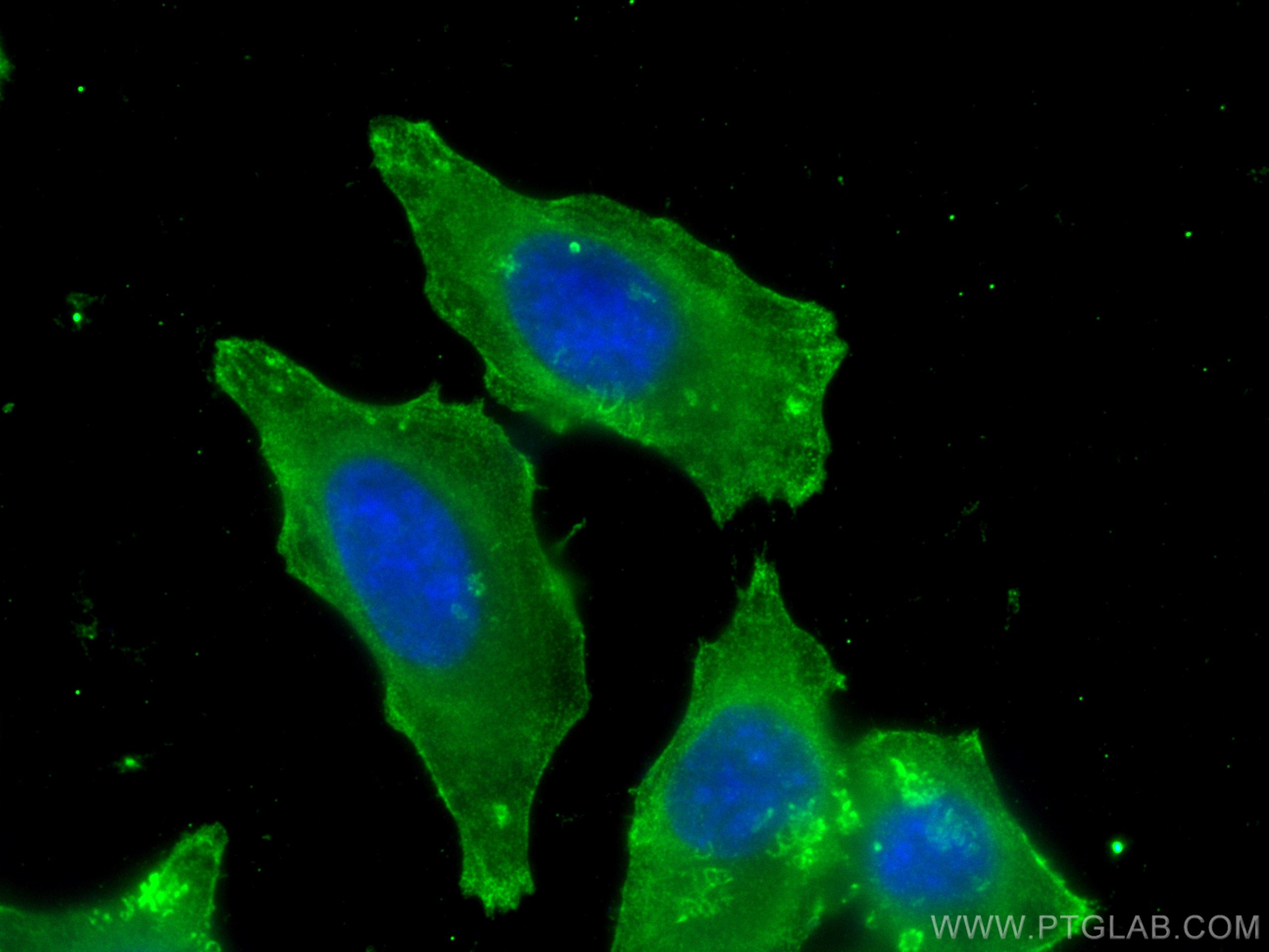 IF Staining of HepG2 using 67986-1-Ig