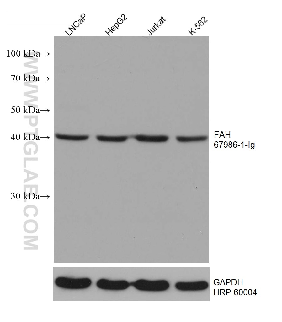 Western Blot (WB) analysis of various lysates using FAH Monoclonal antibody (67986-1-Ig)