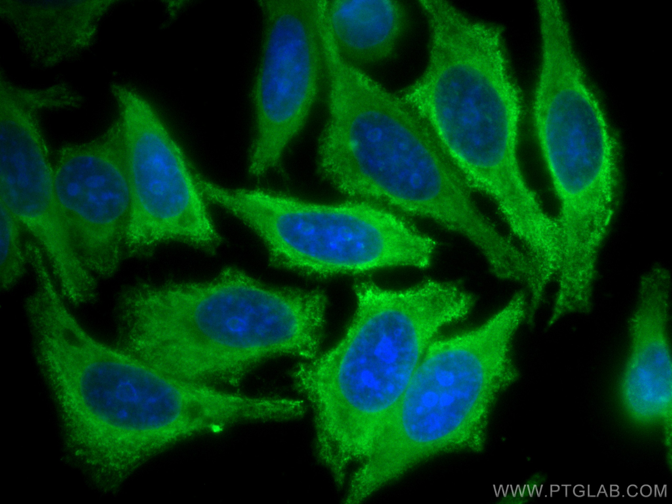 Immunofluorescence (IF) / fluorescent staining of HepG2 cells using CoraLite® Plus 488-conjugated FAH Monoclonal antib (CL488-67986)