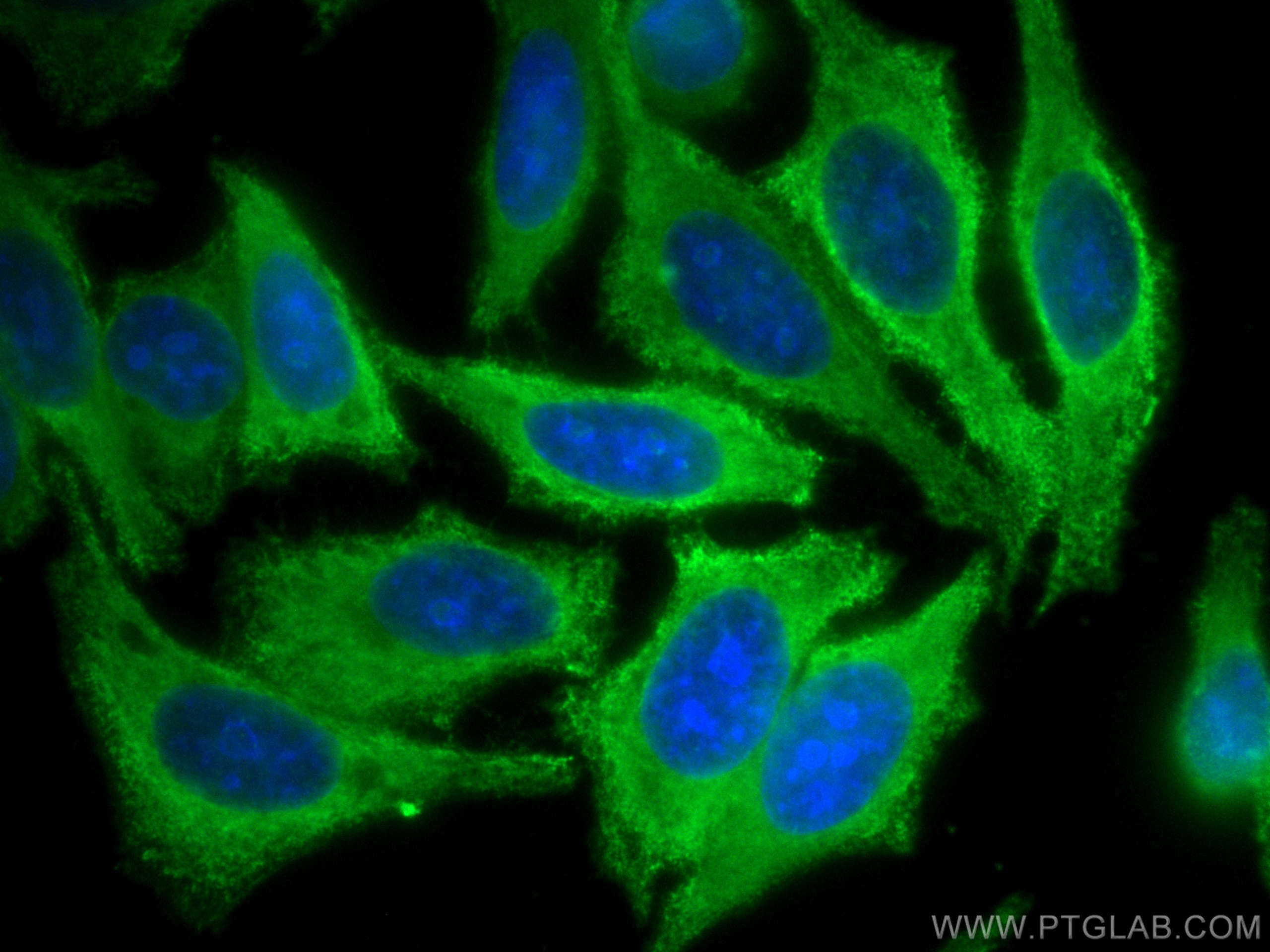 IF Staining of HepG2 using CL488-67986