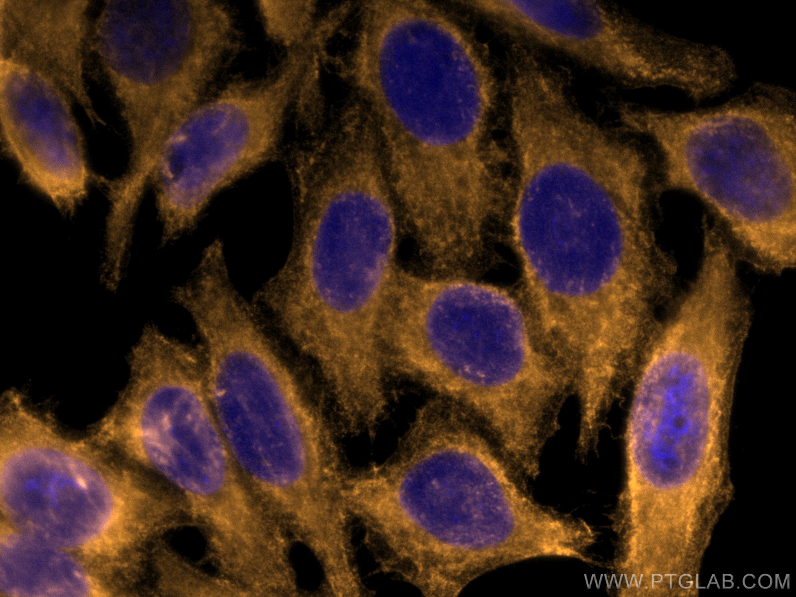 Immunofluorescence (IF) / fluorescent staining of HepG2 cells using CoraLite®555-conjugated FAH Monoclonal antibody (CL555-67986)