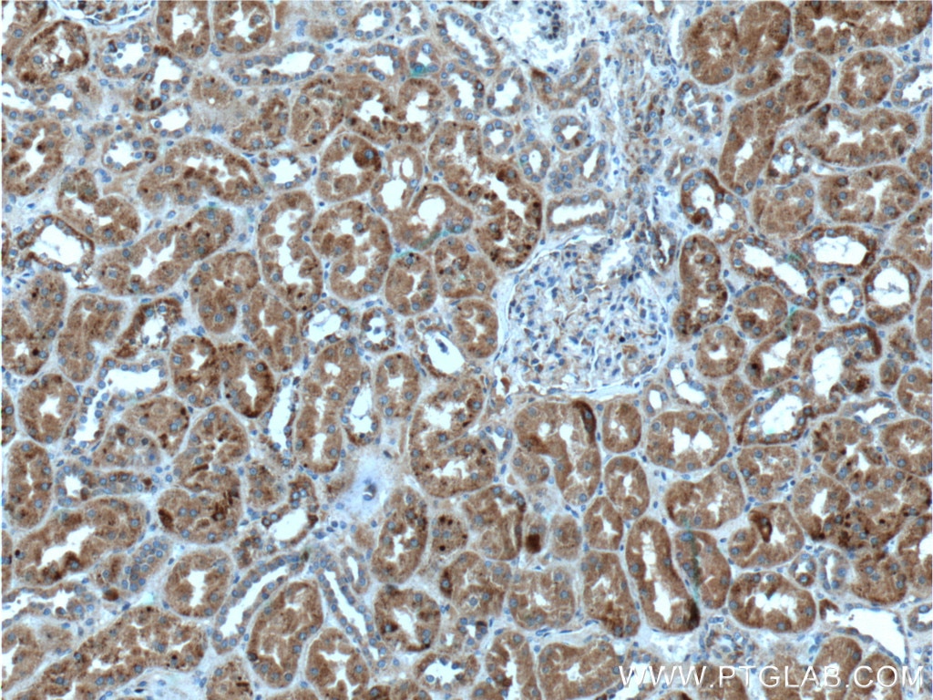 Immunohistochemistry (IHC) staining of human kidney tissue using FAHD1 Polyclonal antibody (26233-1-AP)