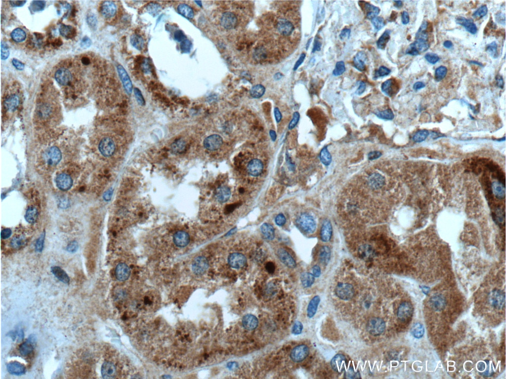 Immunohistochemistry (IHC) staining of human kidney tissue using FAHD1 Polyclonal antibody (26233-1-AP)
