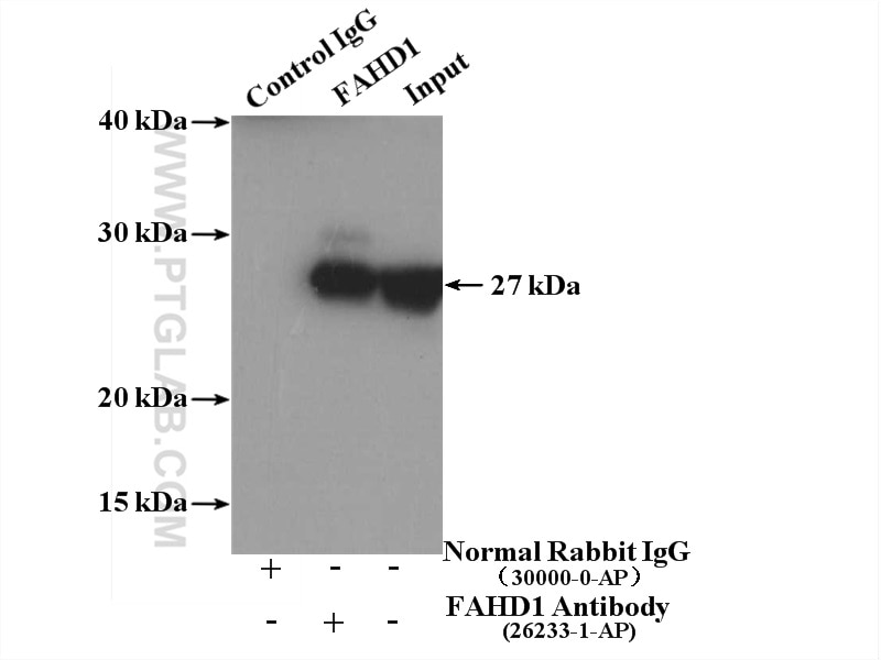 Immunoprecipitation (IP) experiment of mouse kidney tissue using FAHD1 Polyclonal antibody (26233-1-AP)