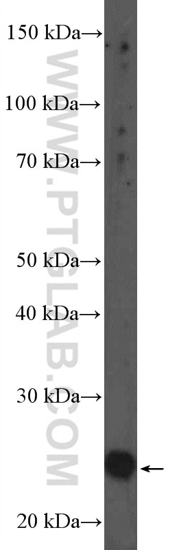 Western Blot (WB) analysis of mouse kidney tissue using FAHD1 Polyclonal antibody (26233-1-AP)