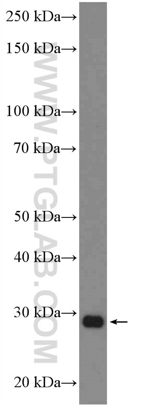 Western Blot (WB) analysis of HeLa cells using FAHD1 Polyclonal antibody (26233-1-AP)