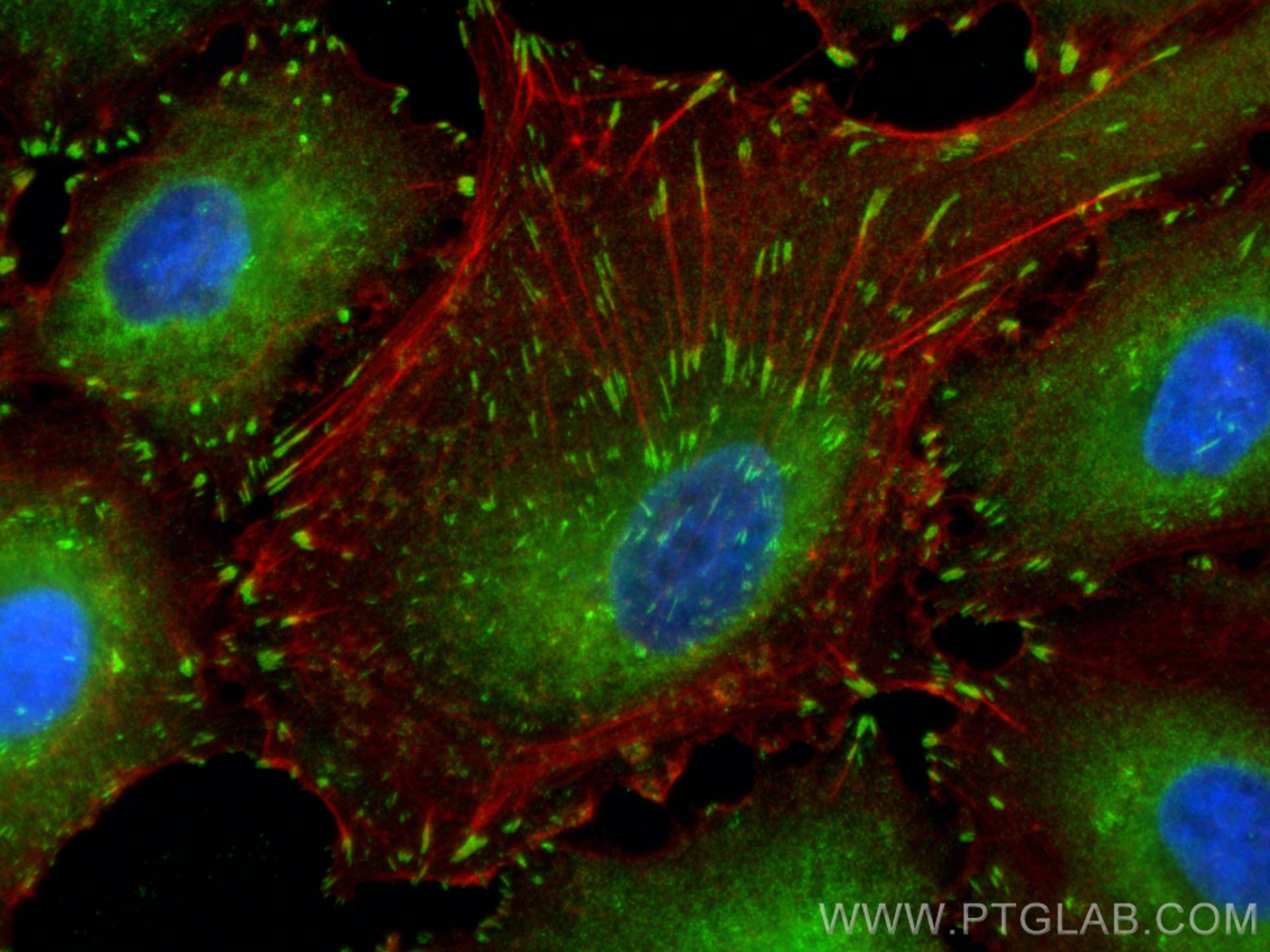 Immunofluorescence (IF) / fluorescent staining of A549 cells using FAK Polyclonal antibody (12636-1-AP)
