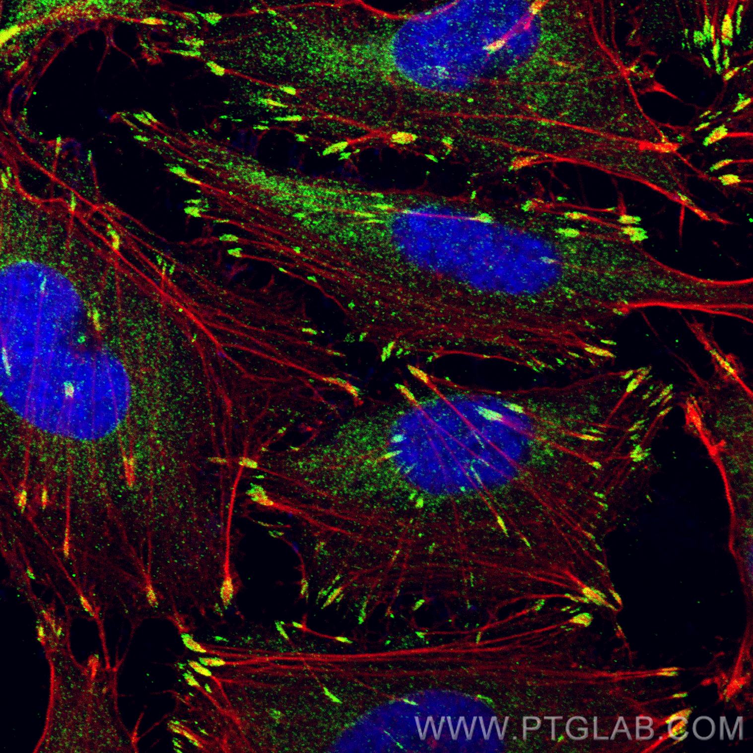 Immunofluorescence (IF) / fluorescent staining of HUVEC cells using FAK Polyclonal antibody (12636-1-AP)