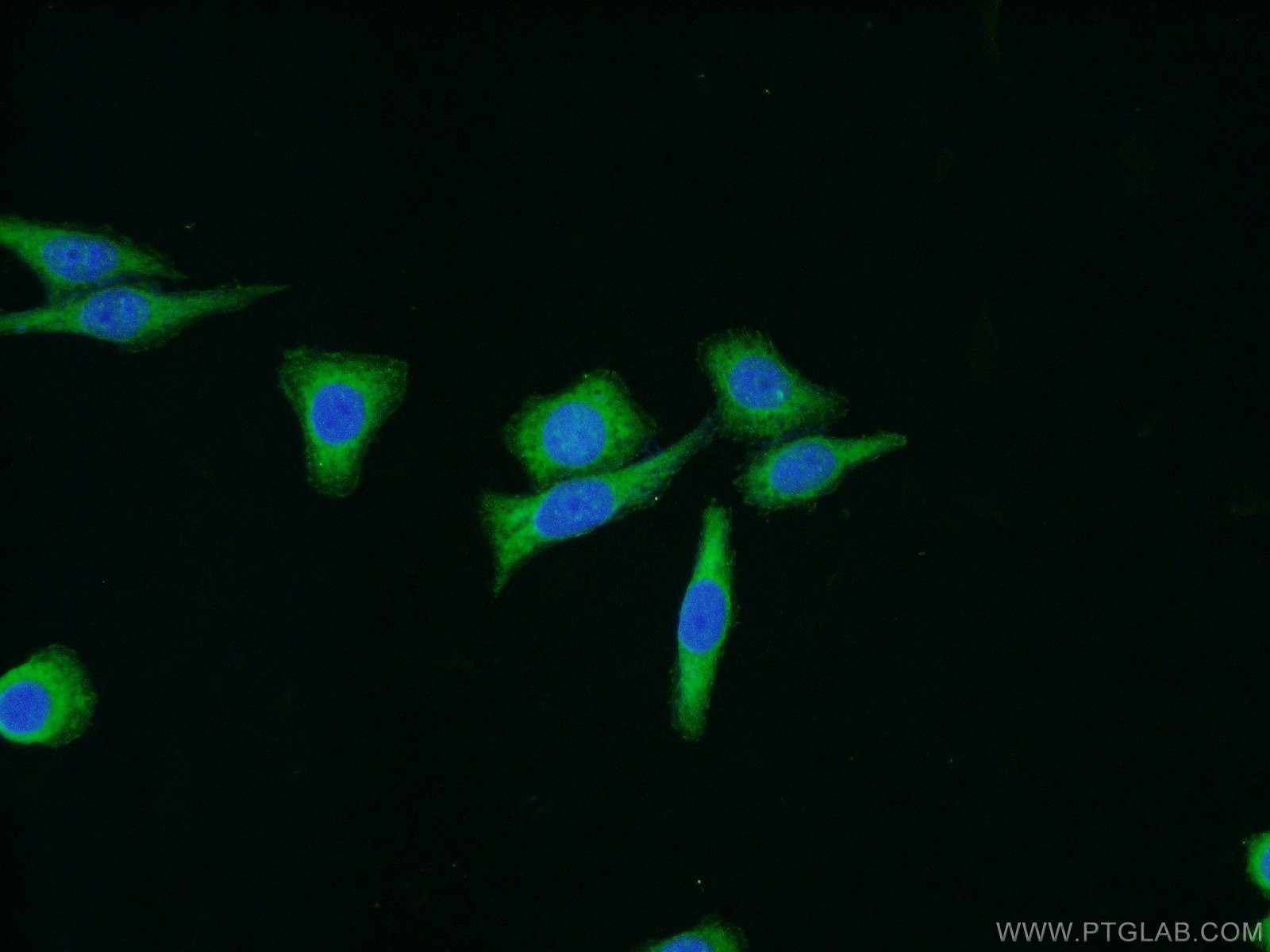 IF Staining of HeLa using 12636-1-AP