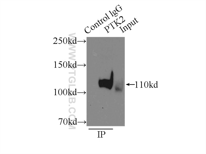 Immunoprecipitation (IP) experiment of mouse brain tissue using FAK Polyclonal antibody (12636-1-AP)