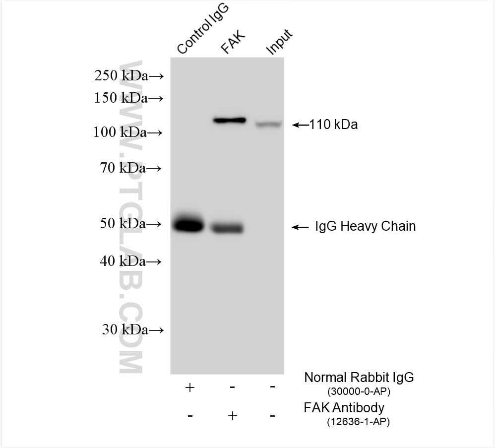 Immunoprecipitation (IP) experiment of HeLa cells using FAK Polyclonal antibody (12636-1-AP)