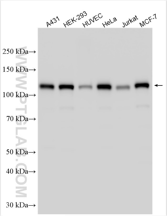 Western Blot (WB) analysis of various lysates using FAK Polyclonal antibody (12636-1-AP)