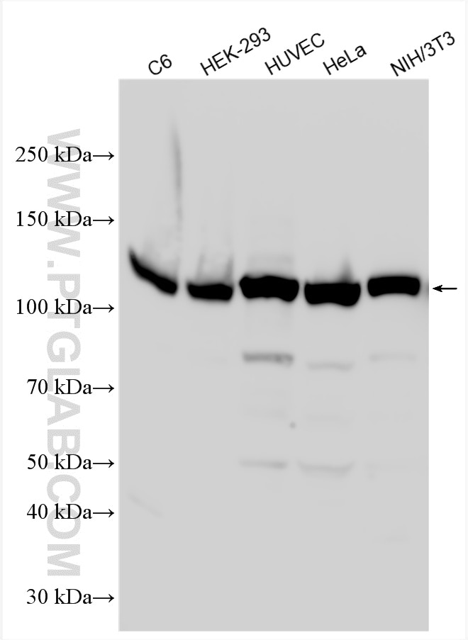 Western Blot (WB) analysis of various lysates using FAK Polyclonal antibody (12636-1-AP)
