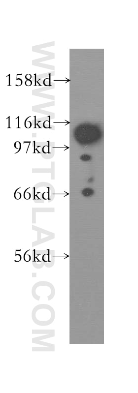 Western Blot (WB) analysis of HeLa cells using FAK Polyclonal antibody (12636-1-AP)
