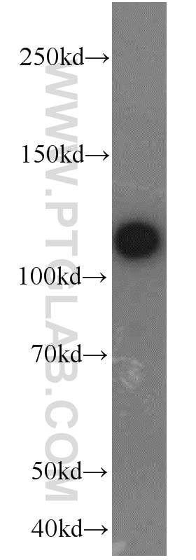 Western Blot (WB) analysis of MCF-7 cells using FAK Polyclonal antibody (12636-1-AP)
