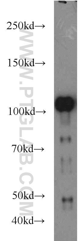 Western Blot (WB) analysis of HEK-293 cells using FAK Polyclonal antibody (12636-1-AP)