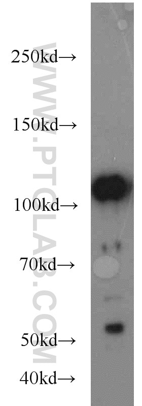 Western Blot (WB) analysis of NIH/3T3 cells using FAK Polyclonal antibody (12636-1-AP)