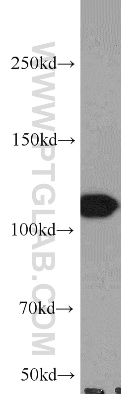 Western Blot (WB) analysis of A431 cells using FAK Polyclonal antibody (12636-1-AP)
