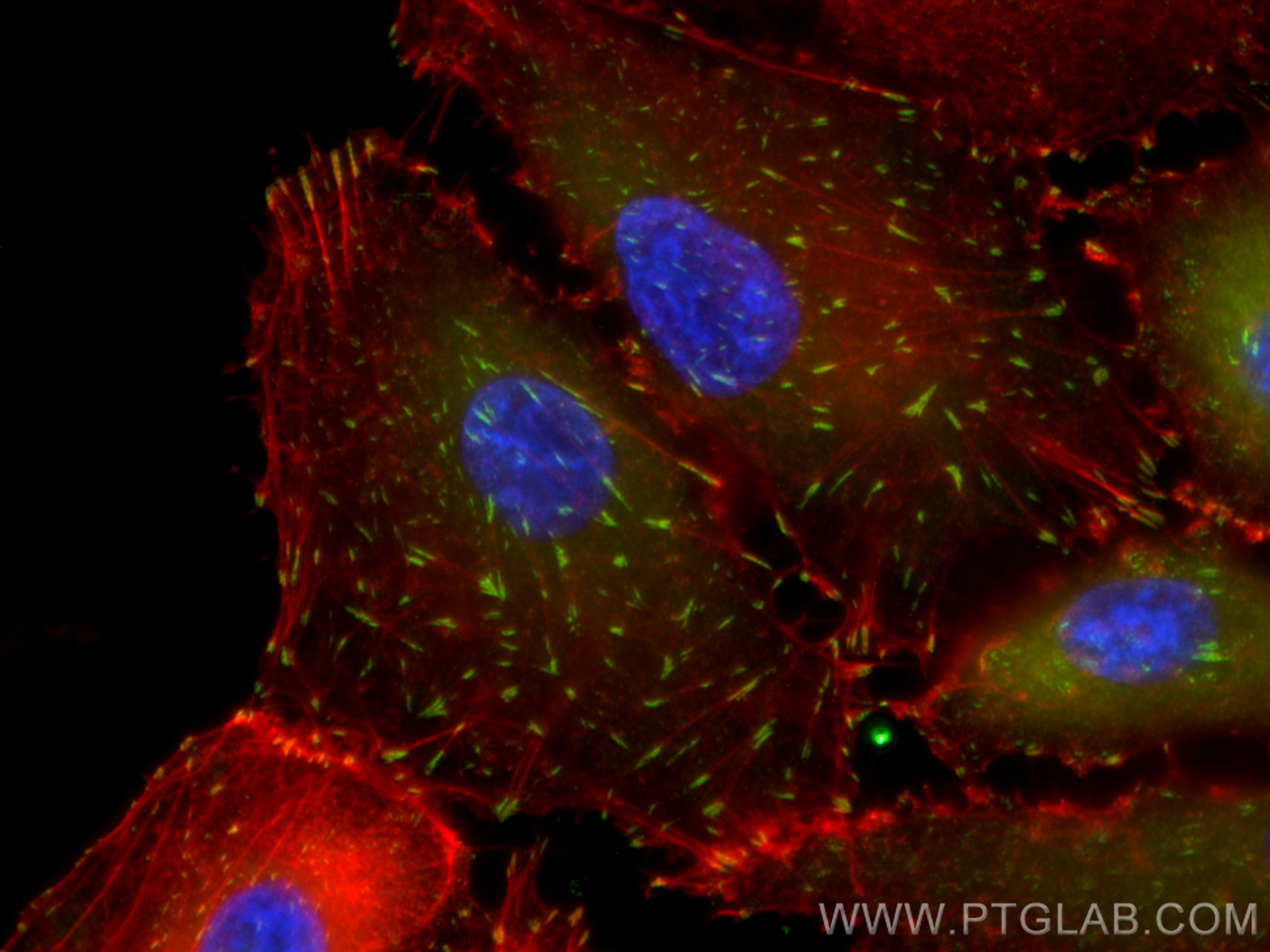 Immunofluorescence (IF) / fluorescent staining of A549 cells using FAK Monoclonal antibody (66258-1-Ig)